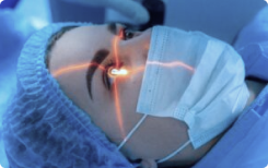 Cirurgia de catarata a laser