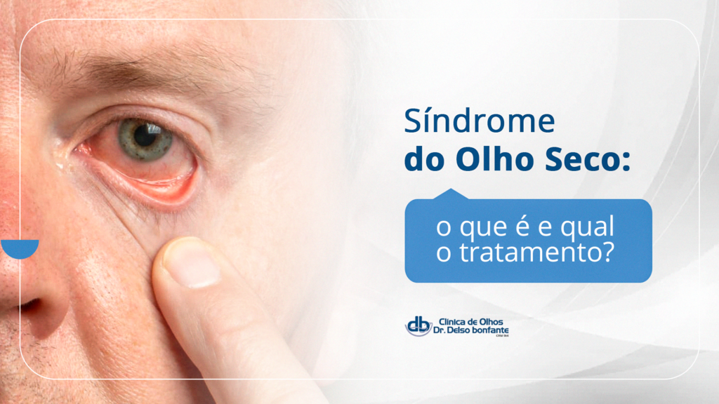 Síndrome do Olho Seco: o que é e qual o tratamento?